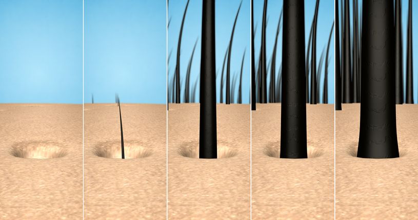 這是一張 1:1 正方形的可愛扁平化醫美資訊圖表，教導大家【預防脫髮方法】與【檢測毛囊健康】。圖中指出，當【遺傳】或【荷爾蒙】失調導致體內【雙氫睪酮】過高時，容易引發【雄性禿】。這會刺激【皮脂腺】分泌過多【油脂】，嚴重堵塞【毛孔】。

若缺乏【營養】、【蛋白質】與【角蛋白】，【微絲血管】與【毛乳頭】無法提供養分，【毛囊】會提早從【生長期】進入【休止期】。這不僅會造成【頭皮】乾癢紅腫，更會引發嚴重【脫髮】。

為了【解決異常掉髮】與【改善髮線後移】，我們必須及早【修復受損毛囊】並【控制頭皮出油】以【改善頭皮環境】。日常可使用【生髮水】配合【深層清潔毛孔】，做好【調理頭皮健康】。若要【治療雄性禿】，建議尋求【專業生髮療程】或【激光】療程。

這些對策能有效【促進血液循環】與維持良好的【血液循環】。這不僅能【補充毛囊營養】、【強健脆弱髮根】，更能【激活休眠毛囊】及【延緩毛囊萎縮】。最終成功【刺激毛囊再生】、【延長生長週期】，大幅【增加頭髮密度】與【改善頭髮稀疏】！