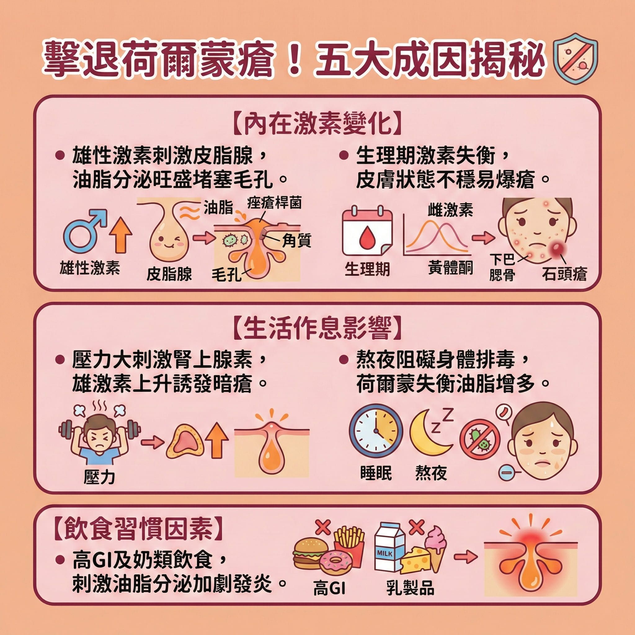 這是一張方形的扁平化向量資訊圖表，主題為「擊退荷爾蒙瘡！五大成因揭秘」，背景採用柔和的粉膚色調。圖表旨在教育大眾關於荷爾蒙瘡成因，特別是針對常長在下巴和腮骨的頑固石頭瘡。

圖表上方是標題，下方分為三個圓角區塊。第一個區塊標題為【內在激素變化】，插圖顯示了荷爾蒙和內分泌系統如何影響皮膚。左側圖示描繪了雄性激素水平上升，刺激皮脂腺過度活躍，產生大量油脂，與老廢角質混合後堵塞毛孔，導致痤瘡桿菌滋生。右側圖示展示了女性生理期週期中，雌激素和黃體酮的波動，解釋了月經前爆瘡這種常見的荷爾蒙失調症狀。

中間區塊是【生活作息影響】，左側插圖畫著一個被壓力壓垮的人，說明壓力如何導致內分泌失調暗瘡。右側是一個時鐘和月亮圖案，強調睡眠不足和熬夜會阻礙排毒，需要建立規律作息來改善荷爾蒙失調。

底部區塊是【飲食習慣因素】，展示了高糖和奶類食物圖標，強調飲食對皮膚的影響，建議進行荷爾蒙瘡戒口並多攝取抗發炎食物以減少油脂分泌。

整體圖表風格可愛且具教育性，隱含了多種解決方案的資訊，例如尋求中醫調理暗瘡以疏肝解鬱及調理內分泌，或者考慮醫美暗瘡治療。日常護膚方面，提示了深層清潔毛孔、溫和去角質以及選擇合適的荷爾蒙瘡護膚品的重要性。對於嚴重的多囊卵巢綜合症暗瘡或因服用避孕藥引起的狀況，則建議諮詢專業意見，並學習正確的石頭瘡急救和去暗瘡印方法，切勿自行擠壓。