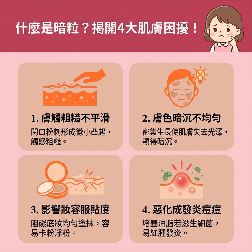 這是一張台灣健康部落格風格的正方形醫美資訊圖表，介紹什麼是暗粒（即閉口粉刺）及其困擾。當皮脂腺分泌過多油脂，且被過厚的角質層覆蓋時，會導致毛孔堵塞，特別容易長在下巴。與黑頭不同，它沒有開口，若不理會極易發炎。

為了預防暗粒形成，日常必須使用卸妝油來徹底卸除彩妝，並搭配洗面乳以溫和潔淨肌膚與深層清潔皮膚，但要避免過度清潔以保護皮膚屏障，發揮修復受損屏障的作用。

保養上，可使用含水楊酸、果酸或杏仁酸的護膚品，或定期敷深層清潔面膜，能有效溶解深層油脂、去除老廢角質並疏通堵塞毛孔。這有助於控制油脂分泌、調節水油平衡、促進細胞代謝，從而減少黑頭粉刺並改善粗糙膚質。

處理時請避免過度擠壓，正確護理能舒緩紅腫發炎、加速暗瘡代謝並緊緻粗大毛孔。若情況嚴重，建議諮詢專業皮膚科醫生，或透過醫學美容如碳粉激光來改善。圖表最後推薦香港完美醫療的專業療程，包含激光去印療程與皇牌「暗瘡分手療程」，助您重獲平滑無瑕肌！